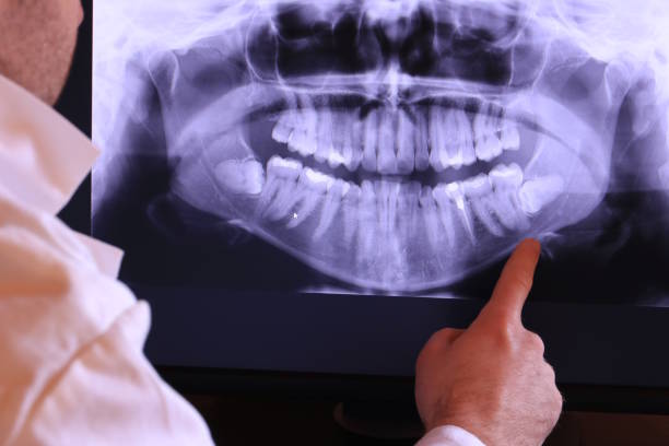 Tooth Infection Emergency Dentist in MS